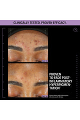 Azelaic & Kojic Advanced Clarifying Serum 1oz