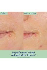 Vinopure Salicylic Spot Solution
