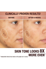 Dark Spot Correcting Radiance Recovery Serum 30ml