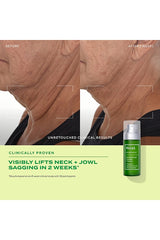 Retinal Resculpt Overnight Treatment