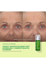 Retinal Resculpt Overnight Treatment