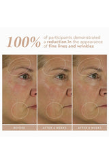 Retinol Reform With 1% Encapsulated Retinol 30ml
