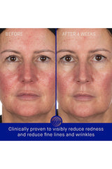 The Hydrogel Face Mask Single