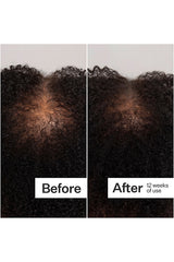 Scalp Dermastamp For Thicker + Fuller Looking Hair