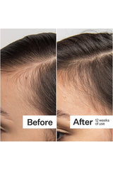 Scalp Dermastamp For Thicker + Fuller Looking Hair