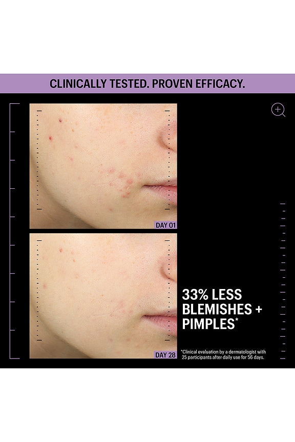 Azelaic &amp; Kojic Advanced Clarifying Serum 1oz