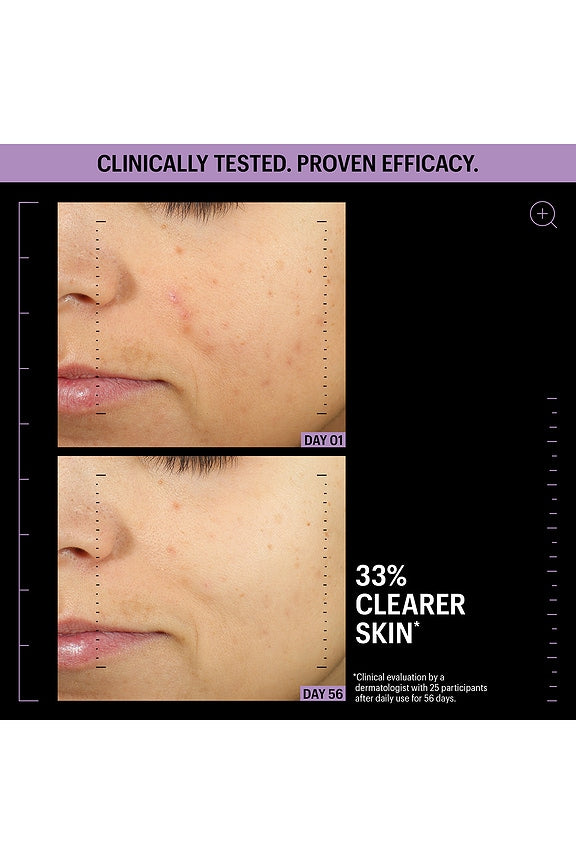 Azelaic &amp; Kojic Advanced Clarifying Serum 1oz
