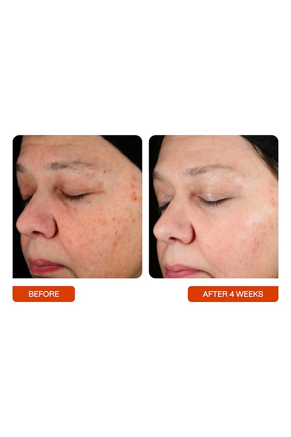 Universal C Skin Refiner