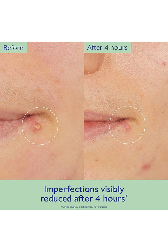 Vinopure Salicylic Spot Solution