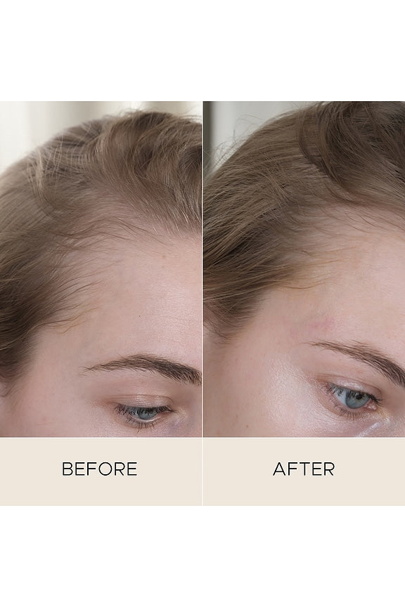 Fortifying Scalp Serum With Amaranth Peptides