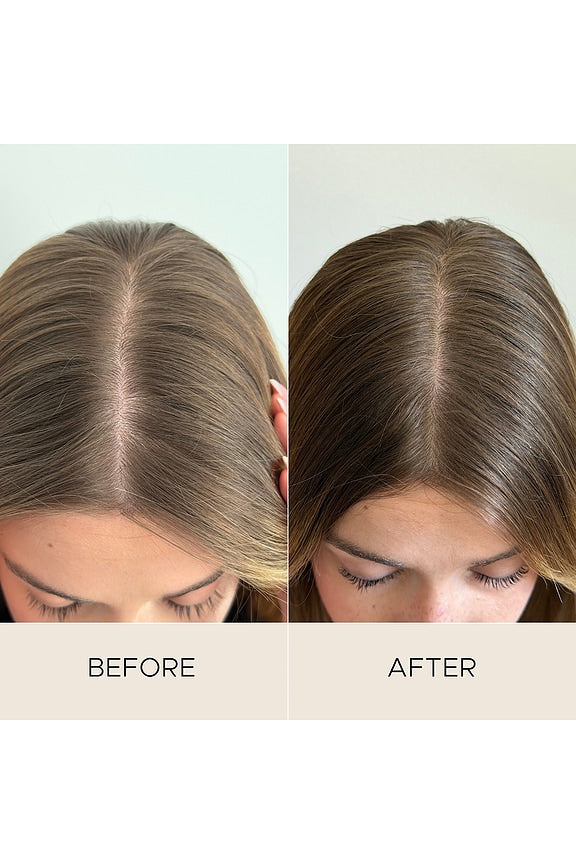 Fortifying Scalp Serum With Amaranth Peptides