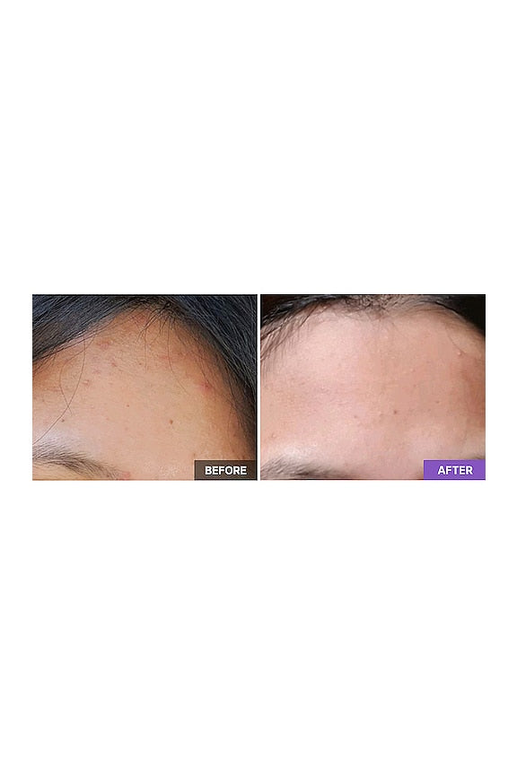 AHA/BHA Clarifying Treatment Toner