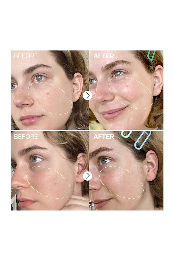 The Vitamin C 23 Serum