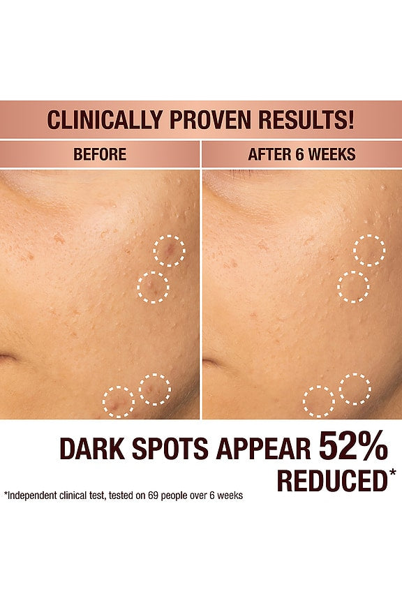 Dark Spot Correcting Radiance Recovery Serum 30ml