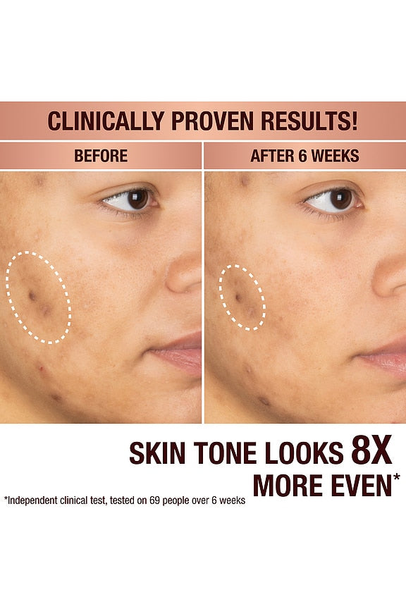 Dark Spot Correcting Radiance Recovery Serum 30ml
