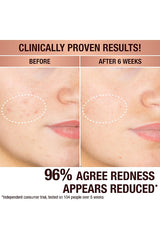 Dark Spot Correcting Radiance Recovery Serum 30ml