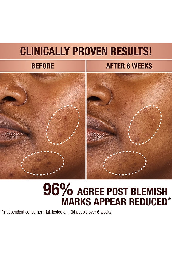 Dark Spot Correcting Radiance Recovery Serum 30ml