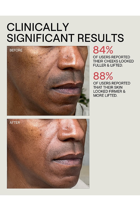 InstaFacial Infusion Biomimetic Microcollagen Matrix