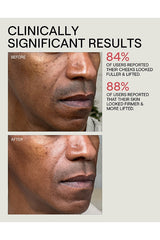 InstaFacial Infusion Biomimetic Microcollagen Matrix