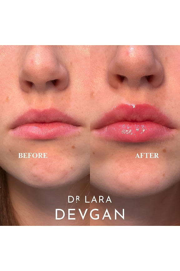 Vermillion Lip Plump