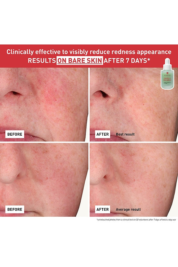 Centella Red Serum for Visible Redness &amp; Immediate Soothing Effect on Sensitive Skin