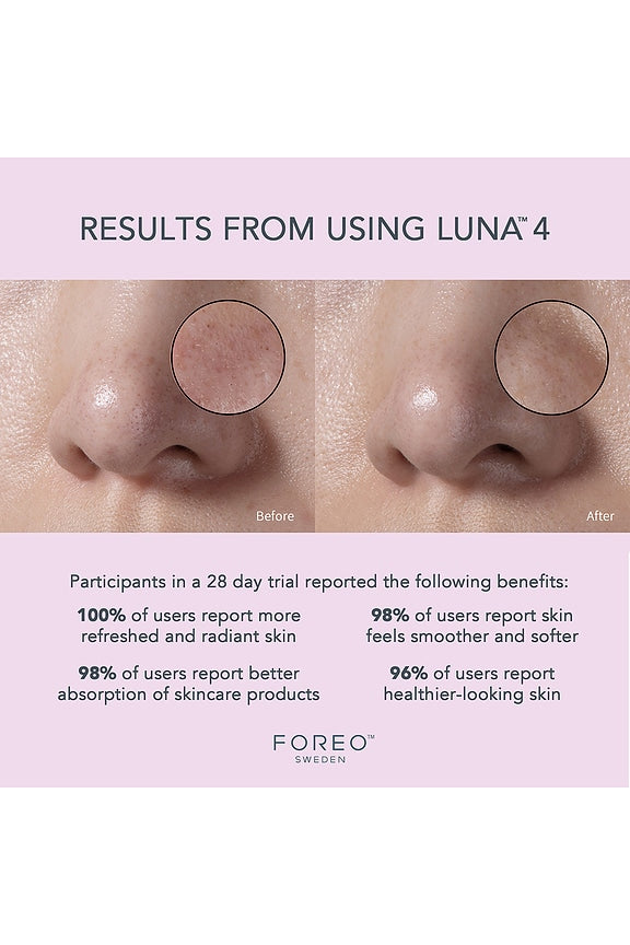 Luna 4 Facial Cleansing &amp; Firming Device For Sensitive Skin