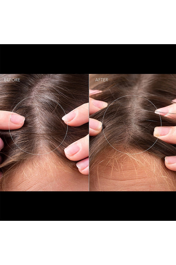 FAQ Scalp Recovery &amp; Thick Hair Probiotic Serum