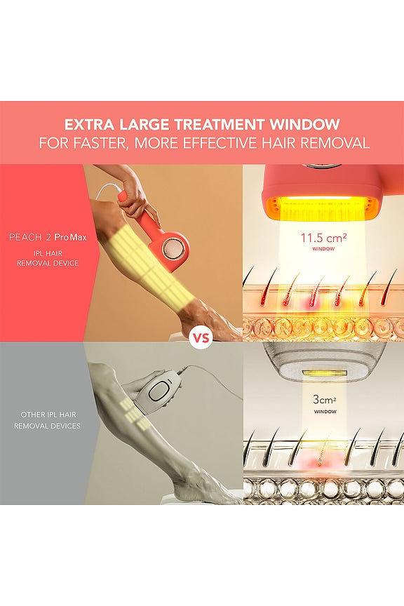 Peach 2 Pro Max IPL Hair Removal Device
