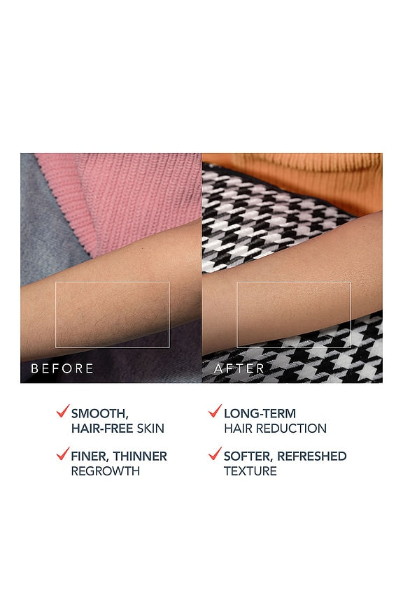 Peach 2 Pro Max IPL Hair Removal Device
