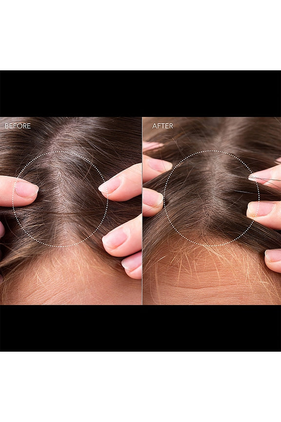 FAQ 302 Laser &amp; LED Hair Regrowth Scalp Massager