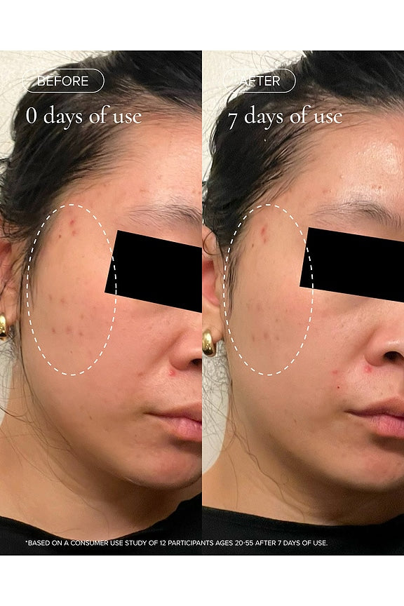 Aura Cleanse Foaming Gel Cleanser
