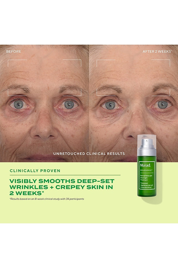 Retinal Resculpt Overnight Treatment