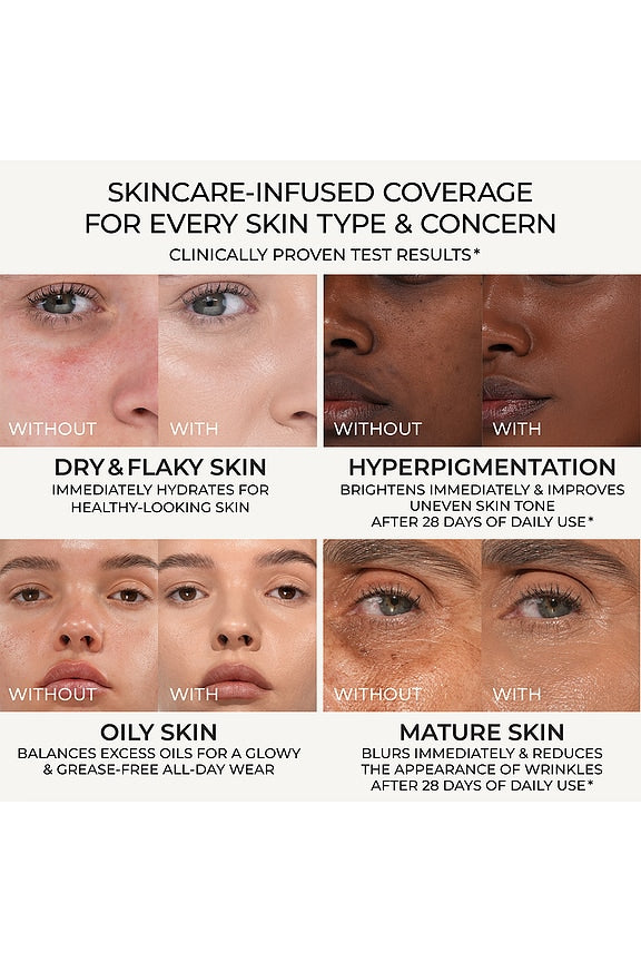 HY-GLAM Foundation