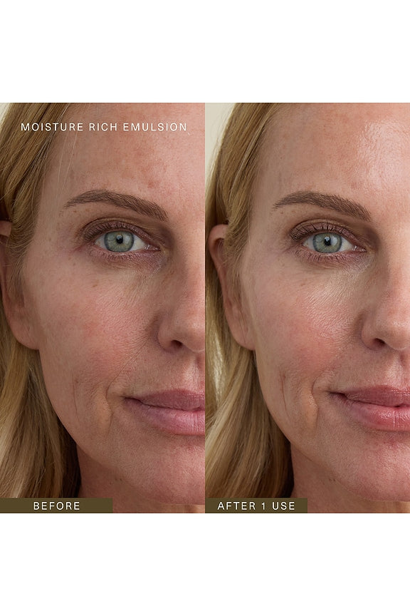 Moisture Rich Emulsion