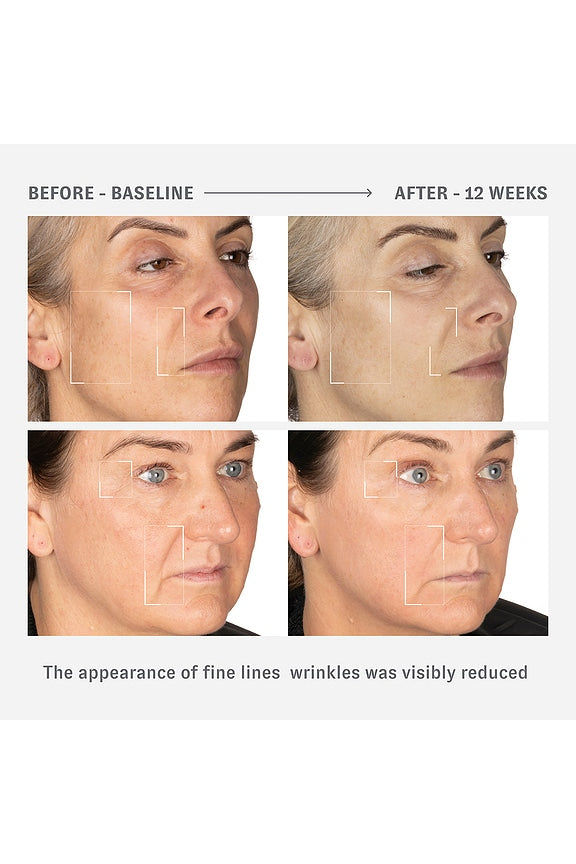 Reverse Activator Wrinkle Cream