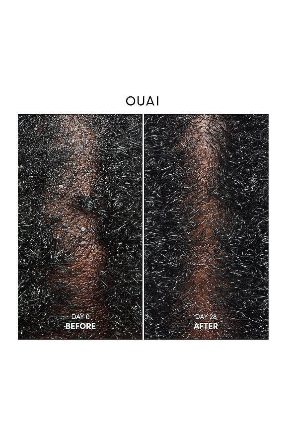 Anti Dandruff Shampoo