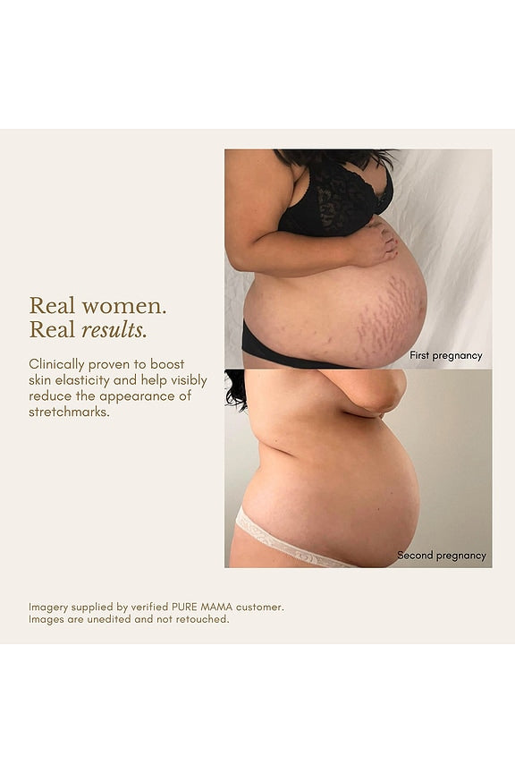 Pregnancy Care Set
