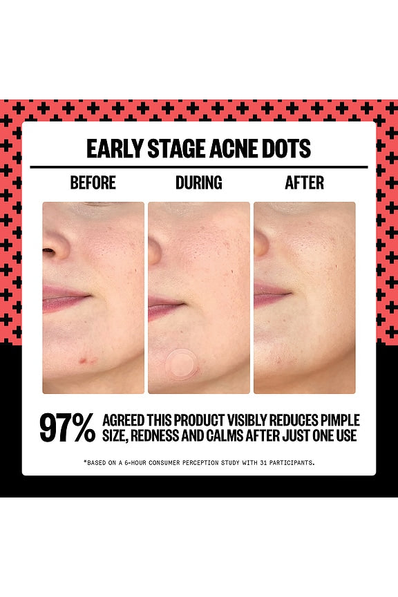 2% Salicylic Acid Early Stage Acne Dot 8 Dots