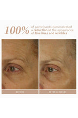 Retinol Reform With 1% Encapsulated Retinol 30ml