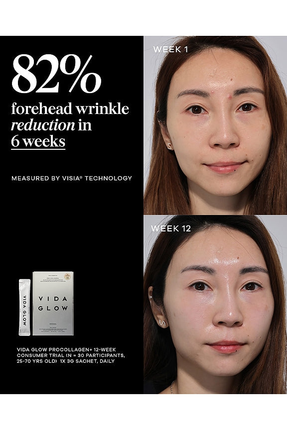 Pro Collagen+