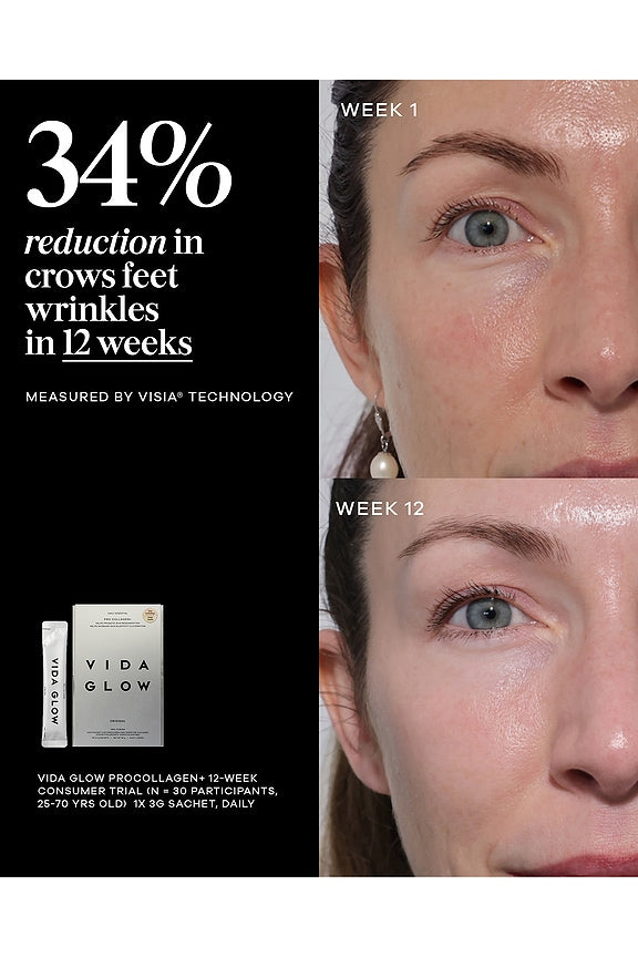 Pro Collagen+